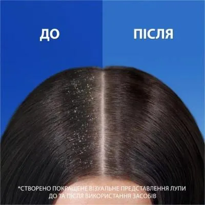 Шампунь Head &amp; Shoulders Против перхоти Основной уход 800 мл (8700216156134) З аукціону