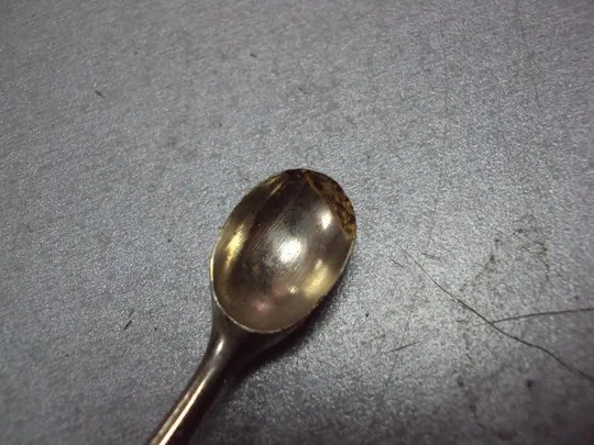 Медицинский инструмент стоматологический хирургический ложечка клеймо длина 18,5 см №11478 Де купити