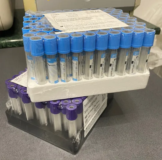 Продаються залишки: витратні лабораторні материали Ціна