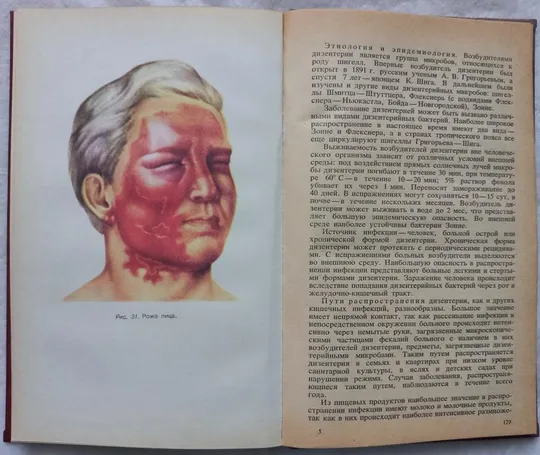 Инфекционные болези с уходом за больными и основами эпидемиологии. В.И. Покровский, И.Г. Булкина З аукціону