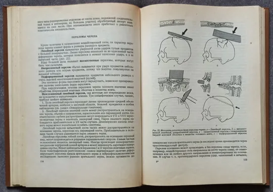 Основы нейрохирургии. Э. Пастор Недорого