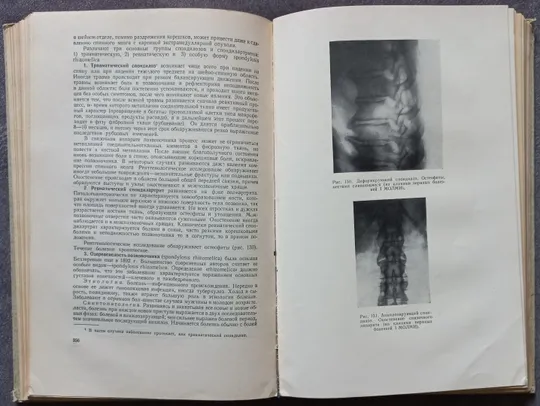 Нервные болезни. Е. К. Сепп, М. Б. Цукер, Е. В. Шмидт Інтернет-аукціон